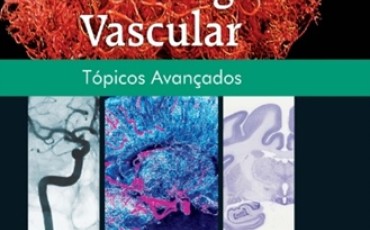 Capítulo 16 em NEUROLOGIA VASCULAR: TÓPICOS AVANÇADOS